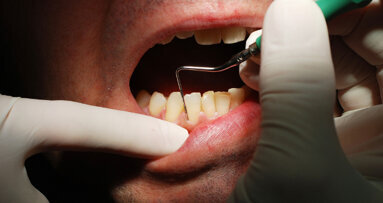 Geschmacksgene beeinflussen Kariesvorkommen