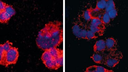 Bakterien können analgetisch wirken