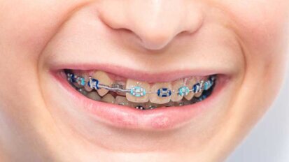 Σιδεράκια Do-it-Υourself