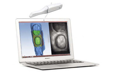 Planmeca ofrece desde tomógrafos a CAD/CAM