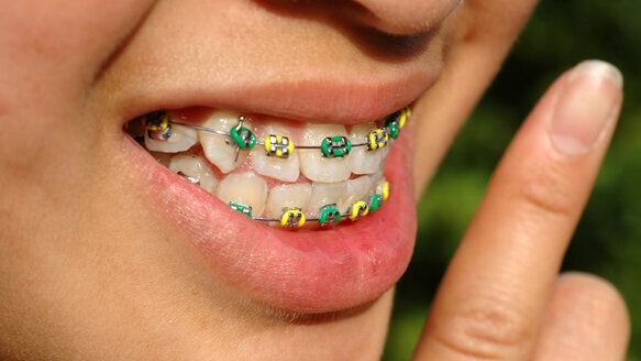 Orthodontics’ future challenging, but bright