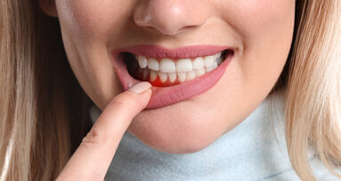 Periodontics a step closer to gaining EU-wide recognition