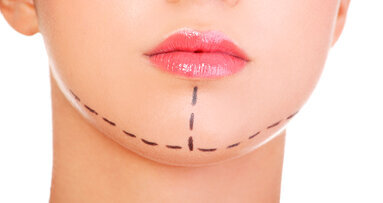 Medicina estetica, AIO: legge 409 abilita gli odontoiatri a tutte le tipologie di cura di denti, bocca, mascelle e relativi tessuti