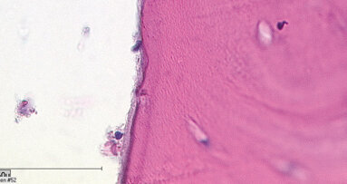 Laser in chirurgia orale e medicina