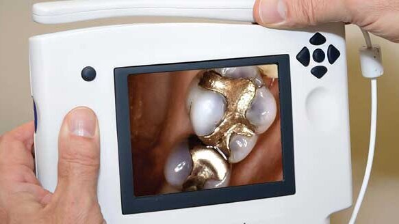 Crisp, clear intraoral images delivered on a screen your patients hold in their hands