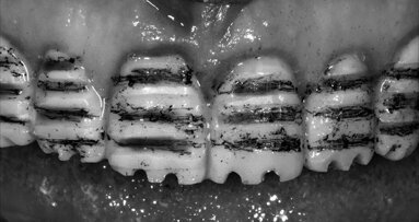 Interdisciplinární přístup v estetické stomatologii