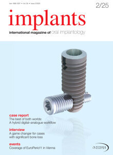 implants international No.2, 2025