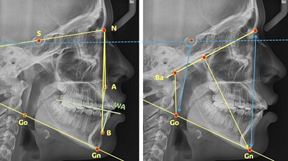 La cefalometría debe contestar las siguientes preguntas