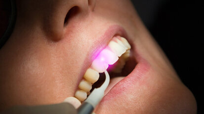 Integrative Lasertechnologie im Fokus Integrative Lasertechnologie im Fokus