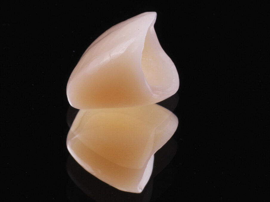 Fig. 7: Structur CAD provisional crown.