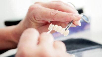 Prothesen direkt vom Zahntechnikermeister?