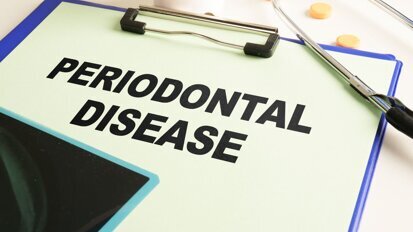 Contour augmentation for periodontal defects (CAPD): A new approach to treating  horizontal periodontal bone loss