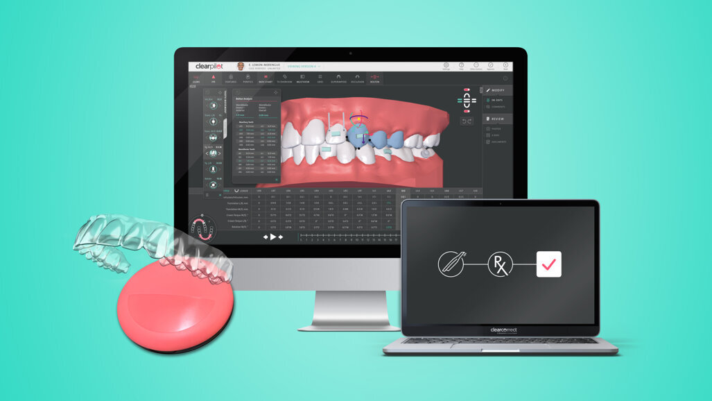 Amplían la gama de productos para alineadores dentales