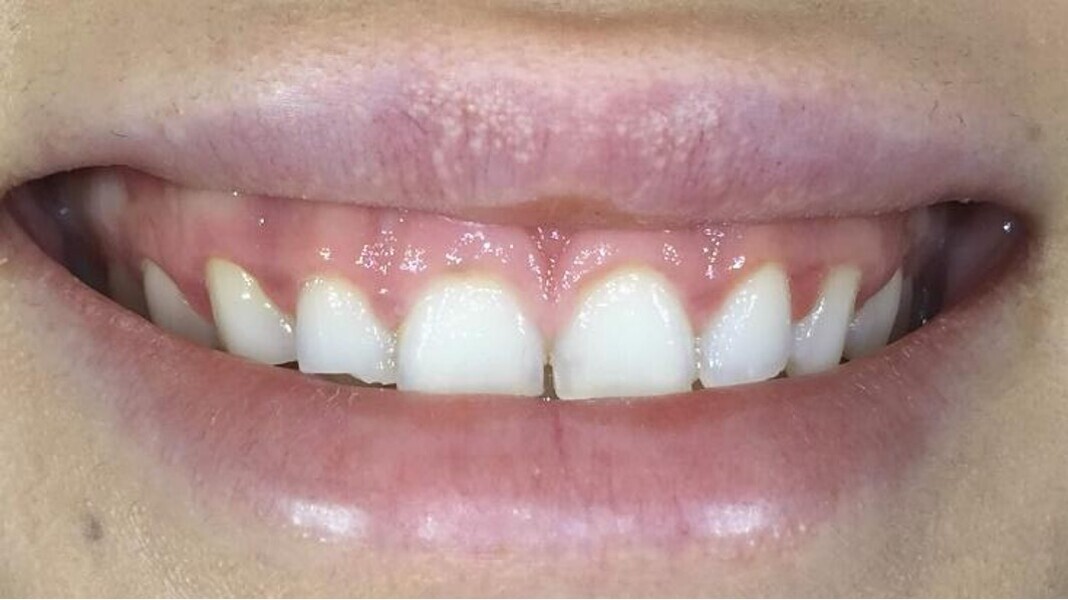 Fig. 3: Close-up view of the patient’s smile.