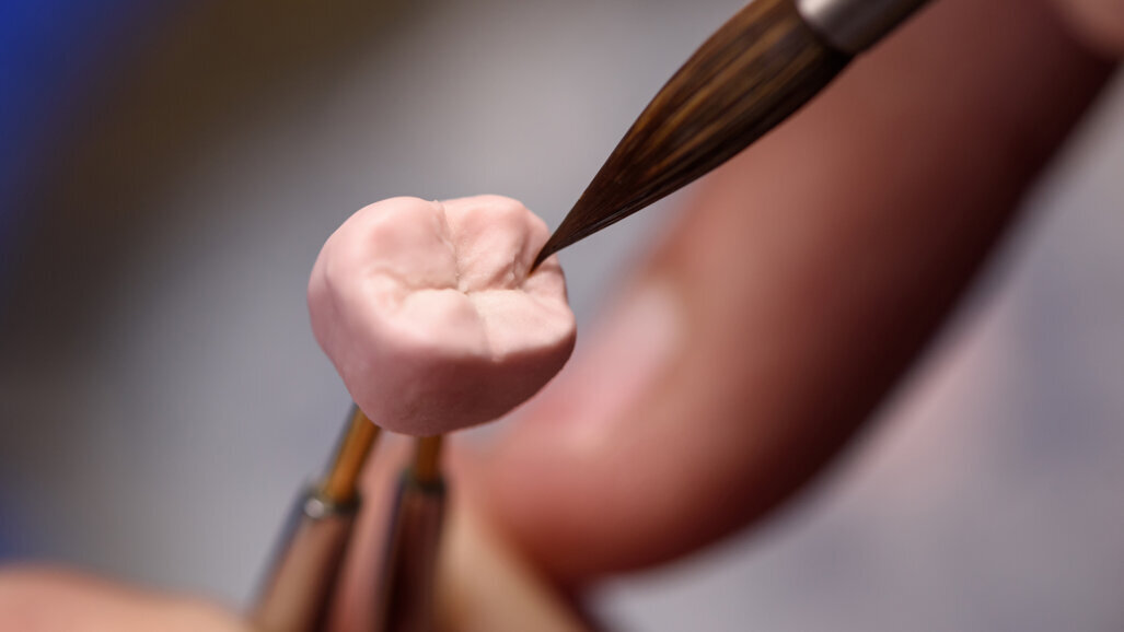 Researchers use generative artificial intelligence to design realistic dental crowns