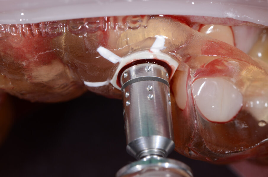 Fig. 28 - Alloggiamento finale.