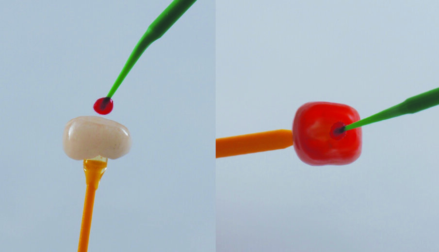 Fig. 9: Etch the crown with hydrofluoric acid after try in and rinse with water. Air dry with oil-free air.