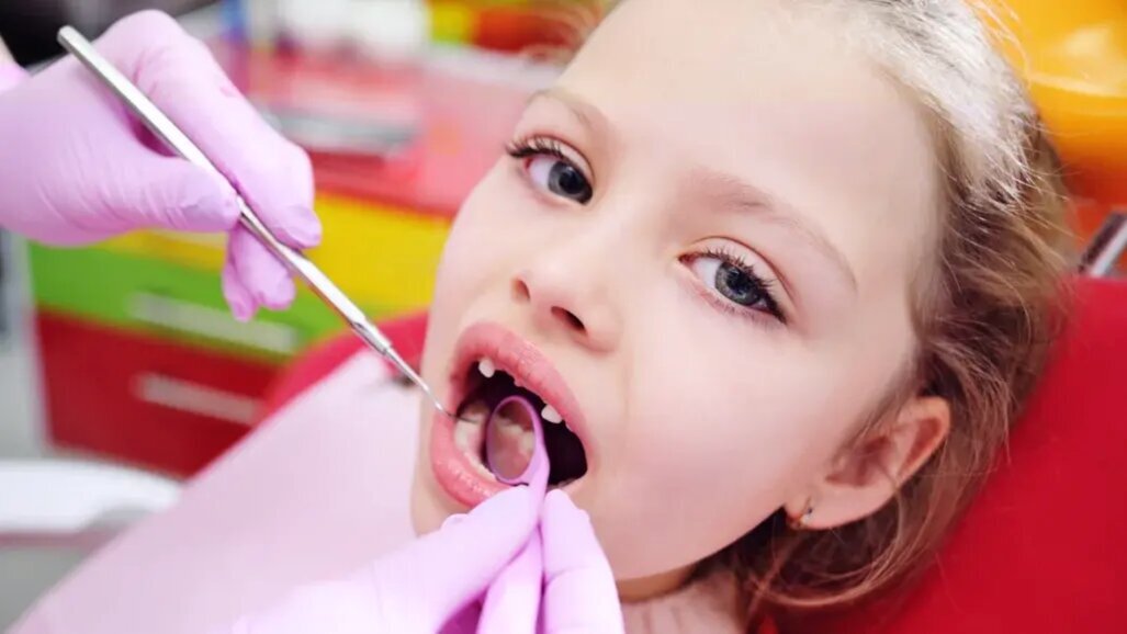 Проучване установява нови бактериални видове, които участват в образуването на зъбни кариеси