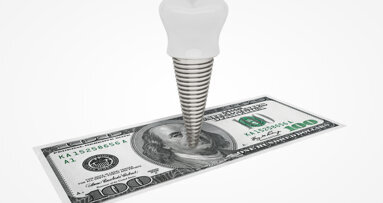 Dental implant market projected to reach US$5.9 bn by 2028