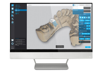 Dental Wings – DWOS Chairside Design Software