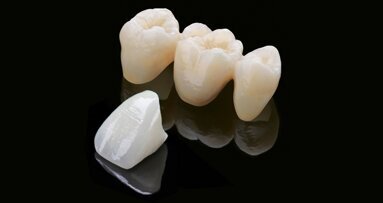 Zirlux FC2 : un système innovant pour des restaurations toujours plus fiables et esthétiques