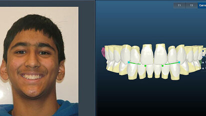 Ormco introduces digital suite, plans ‘debates’ at AAO meeting Ormco introduces digital suite, plans ‘debates’ at AAO meeting