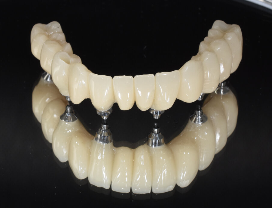 Fig. 19 - Provvisorio.