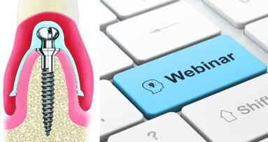 Hands-on als Webinar: Intensivkurs erklärt Fixierung von Totalprothesen