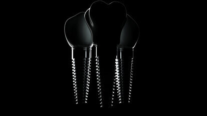 Neoss to host third Global Osseointegration Day on 3 May