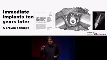 Experience of Dr. Tristan Staas with NobelActive