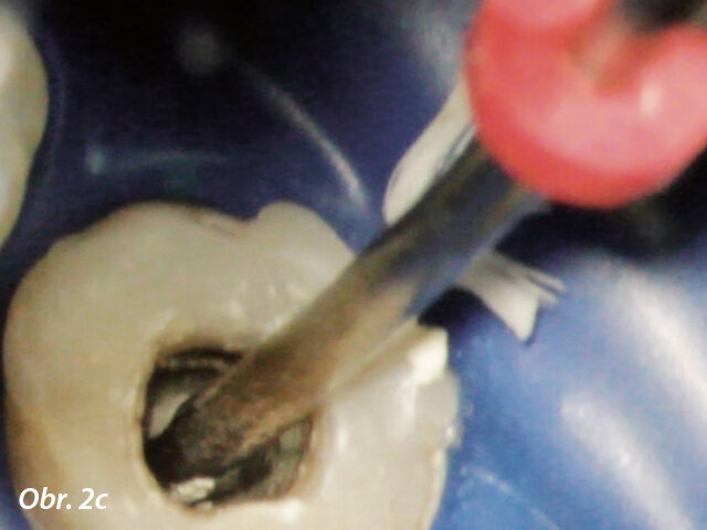 Aplikace PD MTA White s MAP systémem