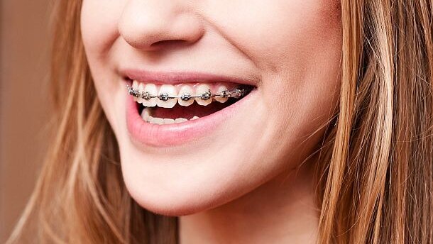 Beugelende tandarts wordt ‘tandarts voor orthodontie’