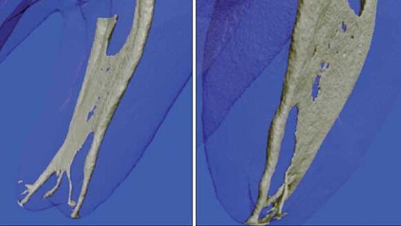 Endodontic irrigants and irrigant delivery systems
