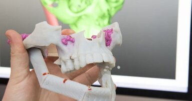 Congresso internacional discute potencial da impressão 3-D em medicina