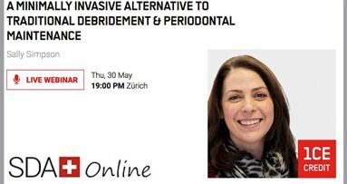 Webinar to focus on alternatives in periodontal maintenance