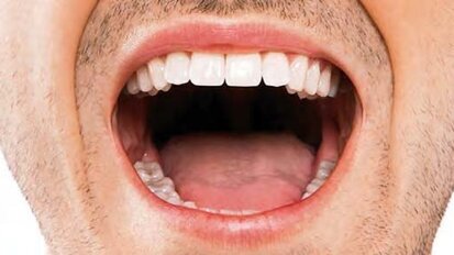 Oralne bakterije mogu biti odgovorne za infekcije koje se prenose hranom