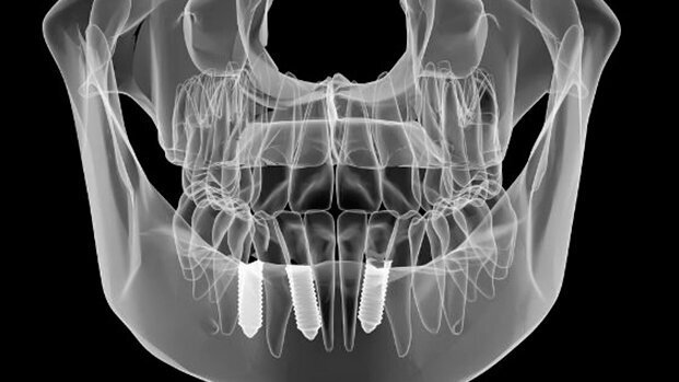 Emersa da una ricerca cinese una certa difformità tra la posizione reale e quella programmata di un impianto