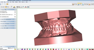TC Cone Beam e scanner in ortognatodonzia: dalla diagnosi al manufatto