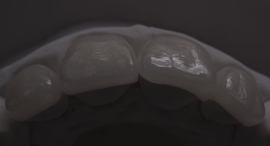 Fig. 19 - Restauro definitivo con tutti i dettagli della texture sul modello in gesso.