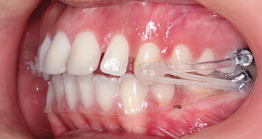 „Sagittal First“