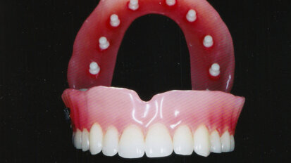 Proteze budućnosti...