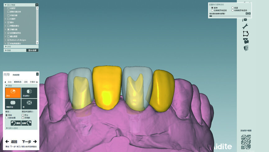 Fig. 38: Design of the bridge.