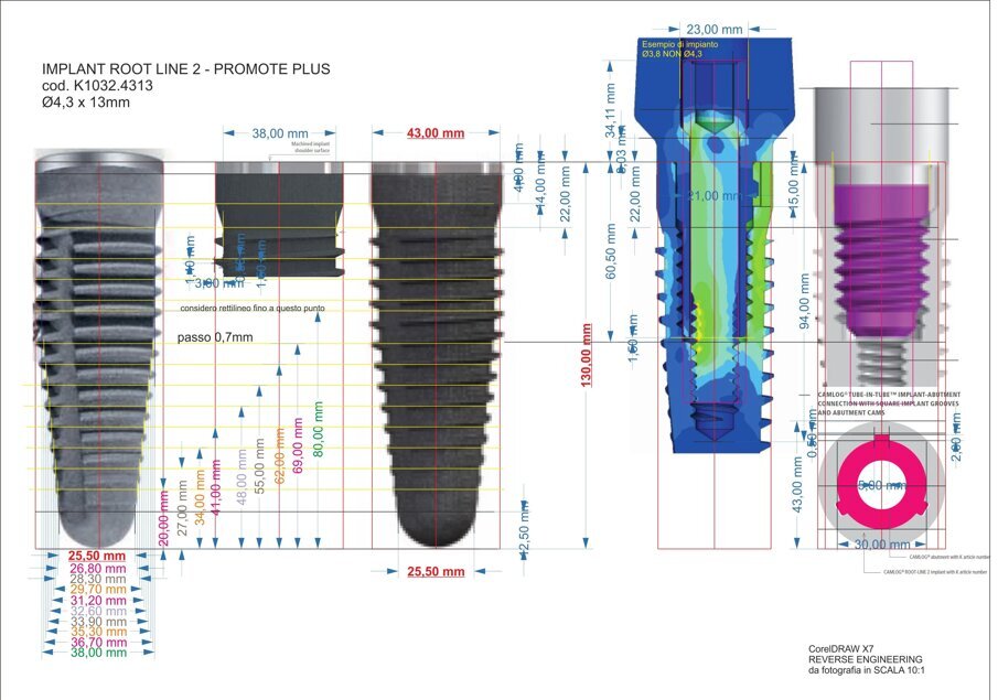 Fig. 4 - Reverse Engineering of the dental implant used as anchorage.