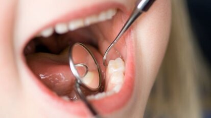 Mondgezondheid tieners verslechterd