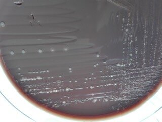 Ryc. 1_Hodowle bakterii, widoczne liczne kolonie bakteryjne