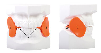 La recidiva in ortodonzia