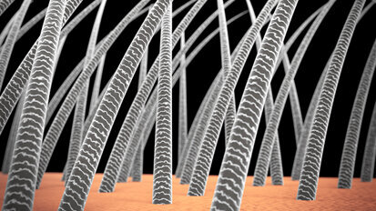 Ricerca: scoperto un legame fra problemi di capelli e carie dentali