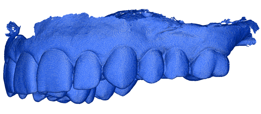 Fig. 7_Scansione dei provvisori in bocca.