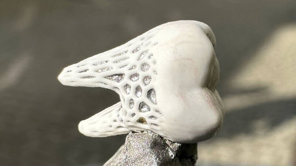 Implanty na miarę – idealnie dopasowane i pozwalające na wrastanie tkanki kostnej