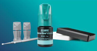 Simplifying the bonding process without compromising on quality